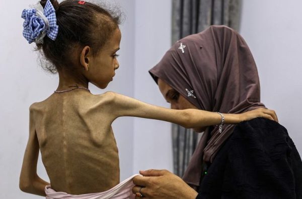 Direct : la famine officiellement déclarée à Gaza par l'ONU  - Famine Gaza Génocide à Gaza Israël ONU