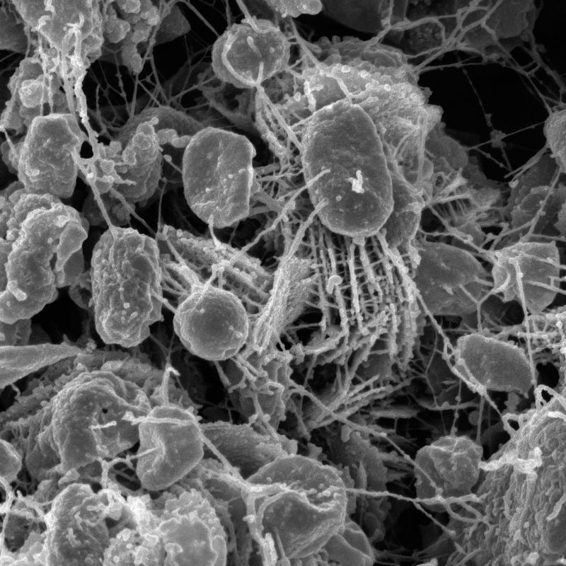 L'IA déniche des antibiotiques cachés dans les microbes les plus anciens de la Terre  - Antibiotiques Découverte scientifique Innovations Intelligence artificielle Sciences